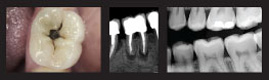 4791_AL_EV_EM_0811_Clinical_Images